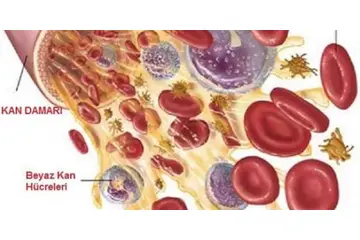 Trombosit Yüksekliği Bitkisel Tedavi