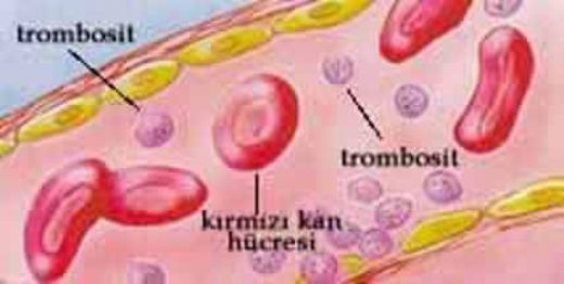 Düşük Trombosit Nedenleri Nelerdir?