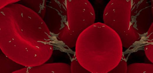 Kanda Trombosit Düşüklüğü Belirtileri ve Tedavisi