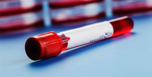 Trombosit Kanseri Belirtileri ve Tedavisi