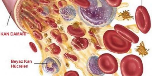 Trombosit Yüksekliği Bitkisel Tedavi